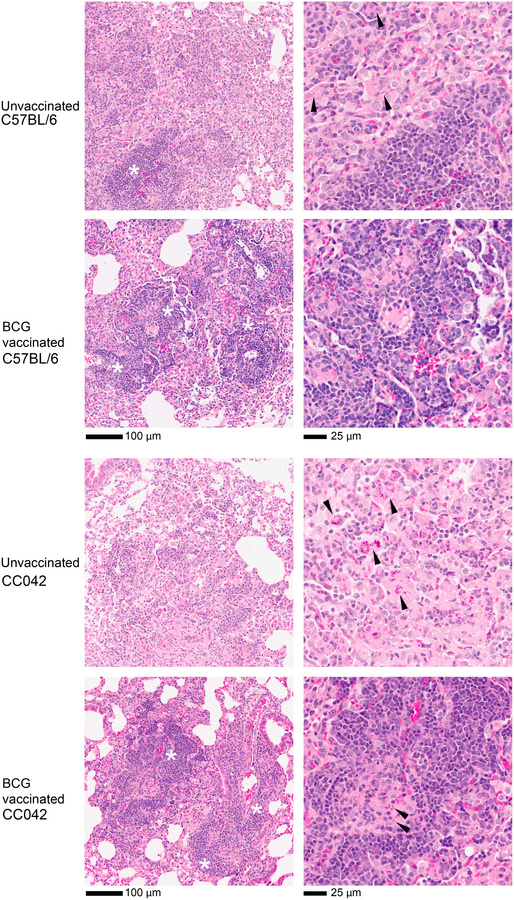 BCG reduces the severity of disease in the lungs of CC042 mice.
The caud...