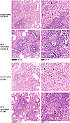 BCG reduces the severity of disease in the lungs of CC042 mice.
