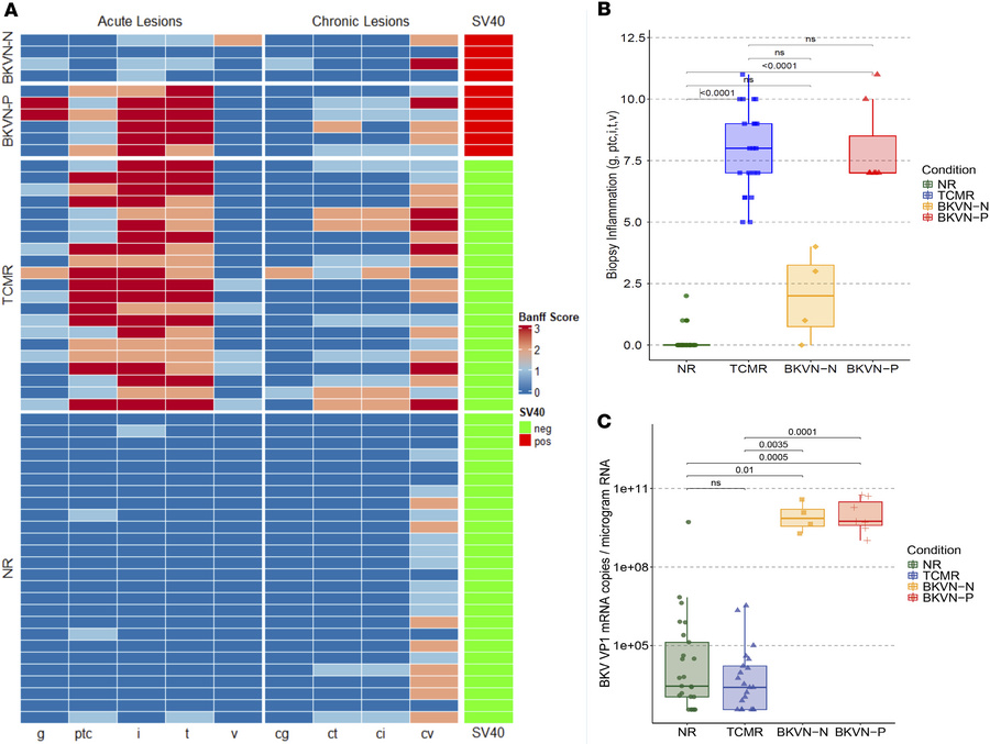 Banff lesion scores in kidney allograft biopsies and BKVN-VP1 mRNA copy ...