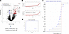 Transcriptomic signature discriminating TCMR from BKVN.