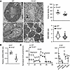 Reduced mitochondrial mass and respiration in Clc-k2–/– TALs.