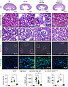 Wnk4D561A/+ rescues the renal histology of Clc-k2–/– mice.
