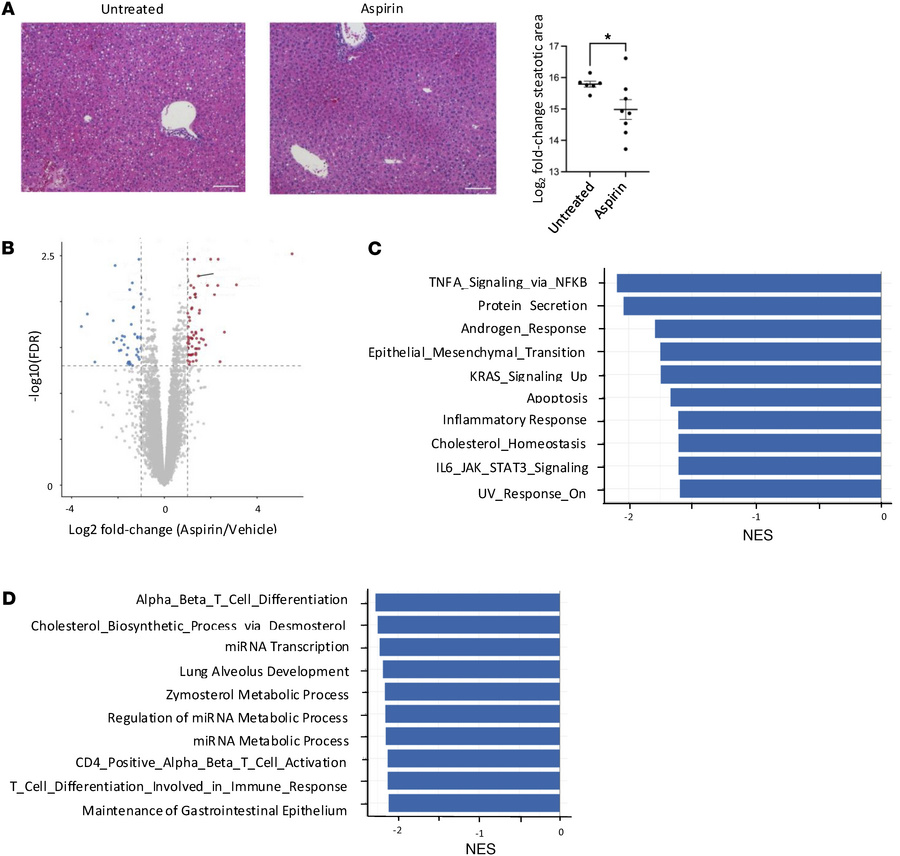 Aspirin ameliorates pathological features of alcohol-associated hepatiti...