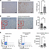 Intrahepatic platelets and circulating platelet-derived microparticles in a