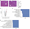 Aspirin ameliorates pathological features of alcohol-associated hepatitis.
