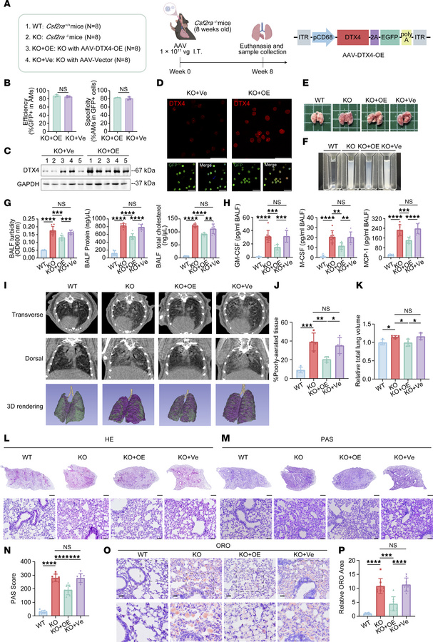 AM-specific DTX4 overexpression ameliorates PAP phenotype in Csf2ra–/– m...