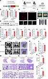 AM-specific DTX4 knockdown impairs pulmonary cholesterol clearance and lung