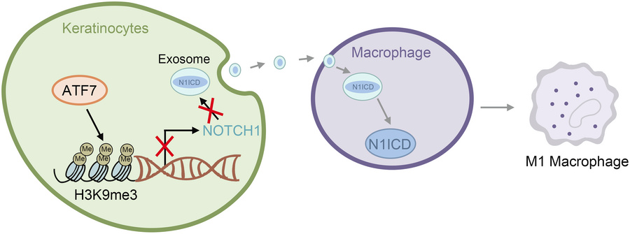 Proposed mechanism.
ATF7 promotes diabetic wound healing by repressing N...