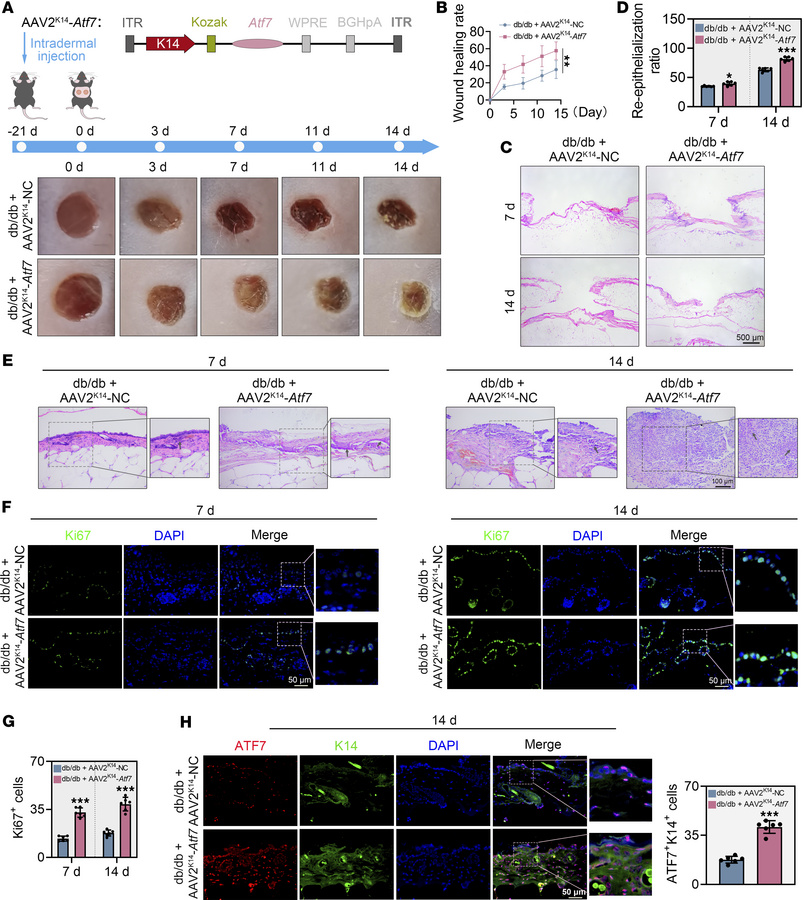 
Atf7 overexpression promotes diabetic wound healing.
(A) Schematic of t...