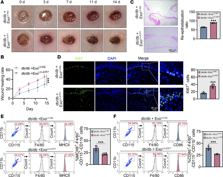 
ATF7-overexpressing keratinocyte-derived exosomes promote diabetic woun...