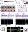 Atf7 overexpression promotes diabetic wound healing.