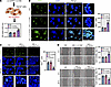 ATF7 promotes the proliferation of keratinocytes under high-glucose conditi