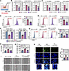 ATF7 overexpression inhibits macrophage M1 polarization.