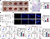 ATF7-overexpressing keratinocyte-derived exosomes promote diabetic wound he
