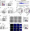 ATF7 transcriptionally represses NOTCH1 and reduces exosomal N1ICD expressi