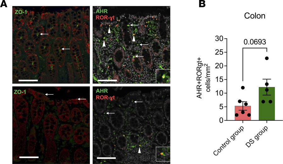 Enrichment of AHR/RORγt-coexpressing cells in dietary indole–supplemente...