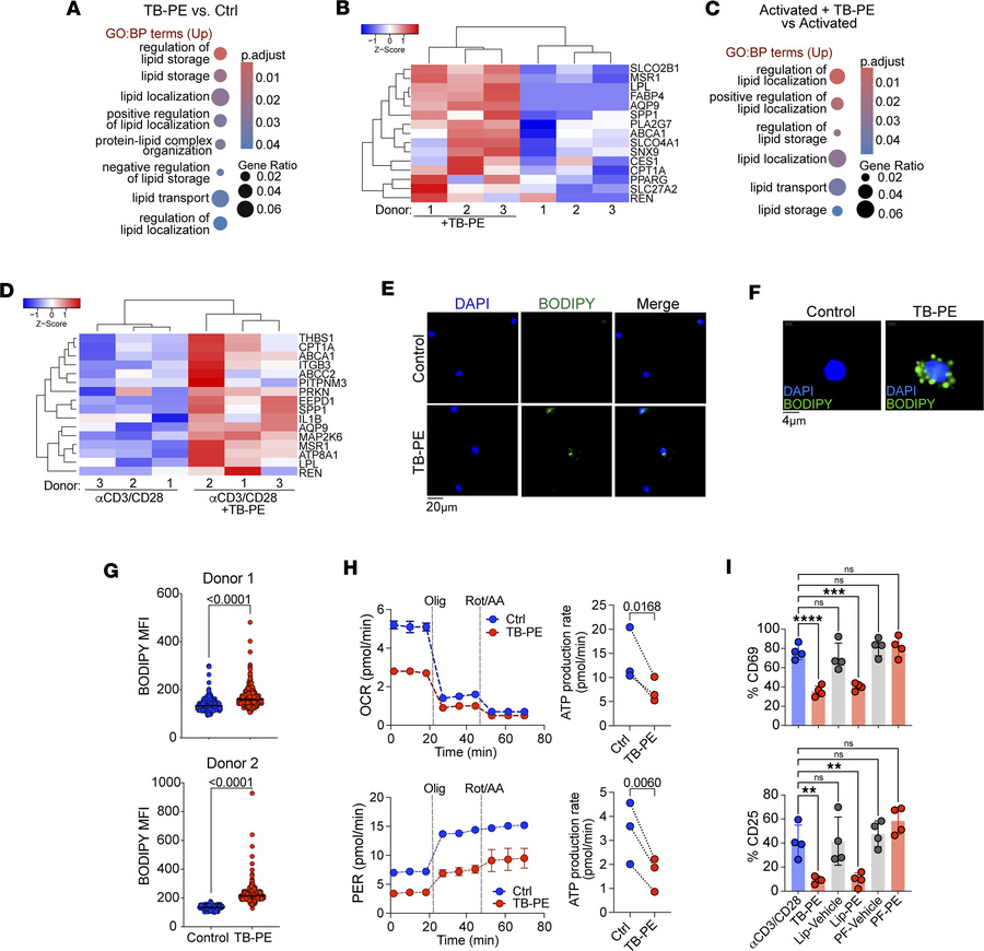 TB-PE–derived lipids accumulate in CD8+ T cells and inhibit T cell activ...