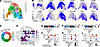 Immunophenotype of TB-PE–derived CD8+ T cells.