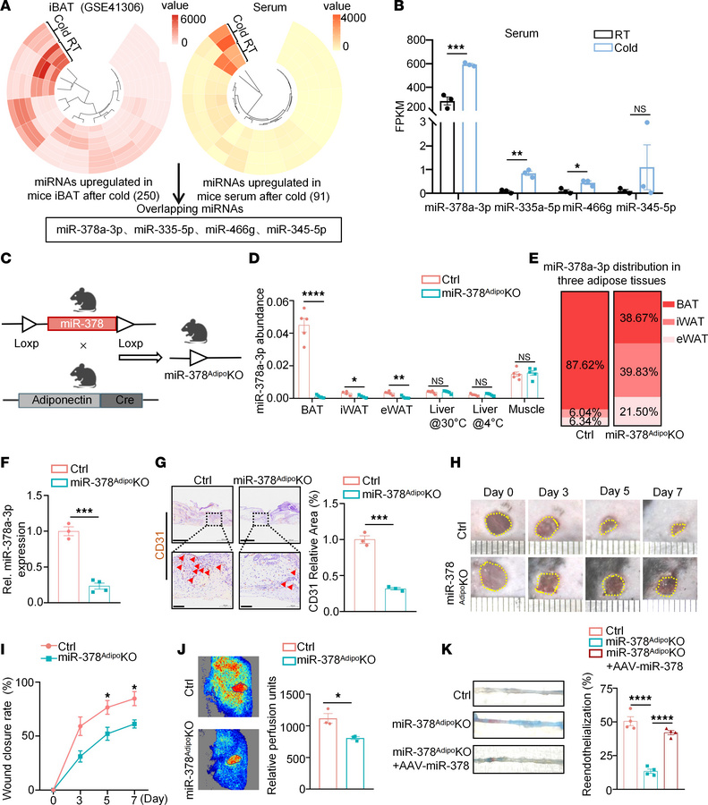 Loss of miR-378 in BAT impairs angiogenesis and delays wound healing.
(A...