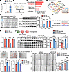miR-378a-3p enhances endothelial angiogenic function by targeting Pten and