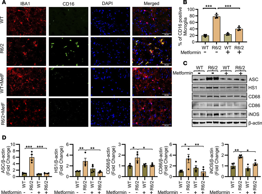 Metformin inhibits proinflammatory microglial activation in HD.
(A) Repr...