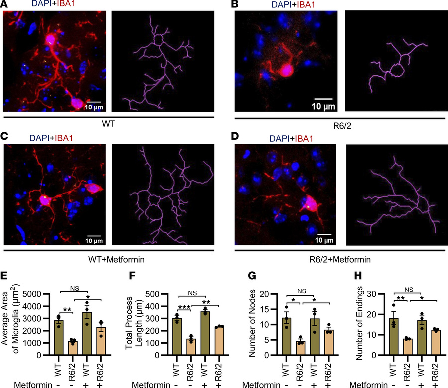 Metformin regulates microglial ramification in HD.
(A–D) Representative ...