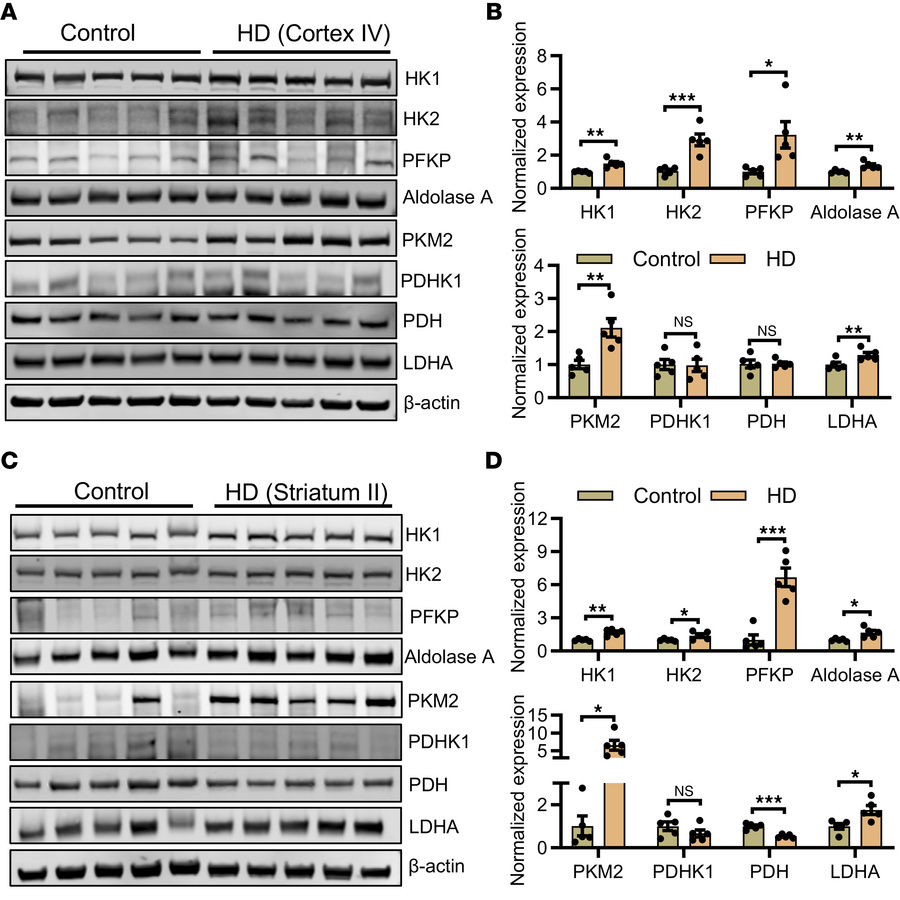 Impaired metabolism in human HD.
(A and B) Immunoblot images of HK1, HK2...