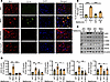 Metformin inhibits proinflammatory microglial activation in HD.