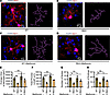 Metformin regulates microglial ramification in HD.