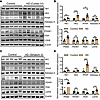 Impaired metabolism in human HD.