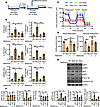 Metformin reprograms microglial metabolism via mitochondrial fission.