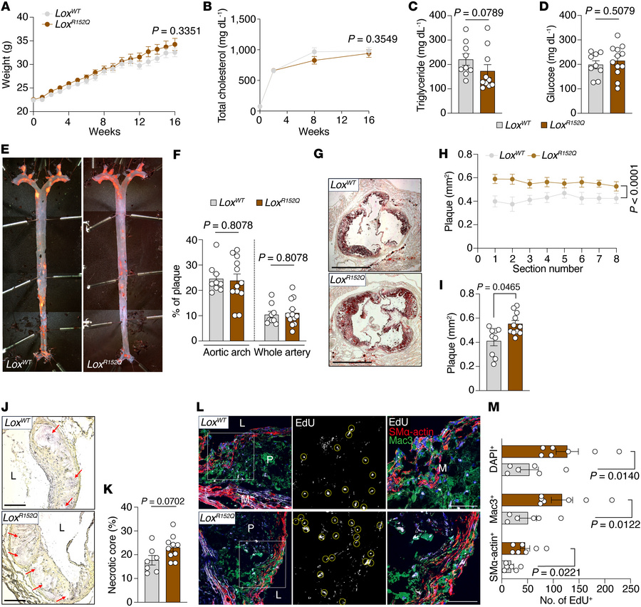 R158Q polymorphism in LOX-PP promotes atherosclerosis and proliferation ...