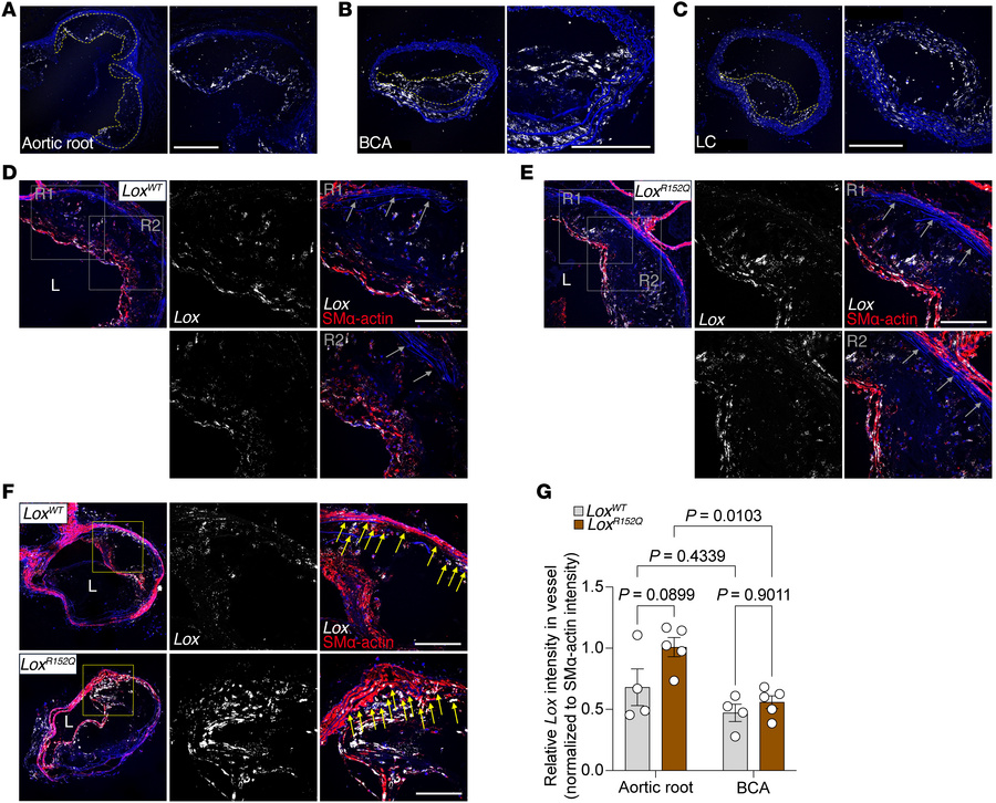 Differential Lox expression patterns in mouse aortic vessels.
(A–C) Diff...