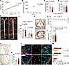 R158Q polymorphism in LOX-PP promotes atherosclerosis and proliferation of