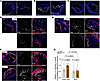 Differential Lox expression patterns in mouse aortic vessels.