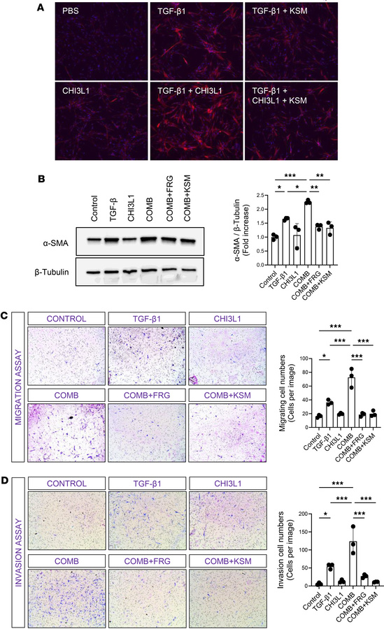 CHI3L1 enhances TGF-β1–induced myofibroblast transformation, migration, ...
