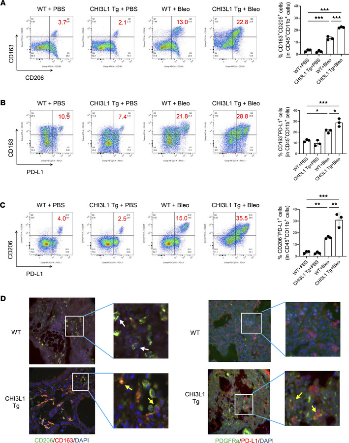 CHI3L1 increases profibrotic macrophages and fibroblasts in bleomycin-ch...