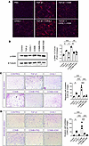 CHI3L1 enhances TGF-β1–induced myofibroblast transformation, migration, and