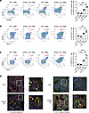 CHI3L1 increases profibrotic macrophages and fibroblasts in bleomycin-chall