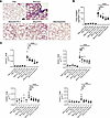 Anti-CHI3L1, anti-PD-1, and bispecific antibodies attenuate bleomycin-induc
