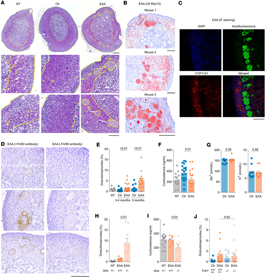 Long-term adrenal pathology in EAA.
(A) Representative H&amp;E-stained a...