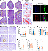 Long-term adrenal pathology in EAA.