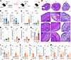 CD4+ T cell–derived IFN-γ drives pathology in the adoptive EAA model.