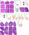 Sex-specific differences in EAA severity with male-restricted granuloma for