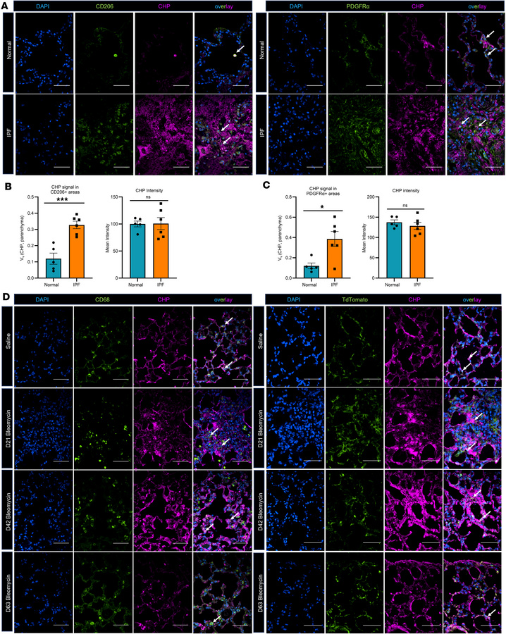 Degraded collagen is increased in IPF lung tissue and bleomycin-injured ...