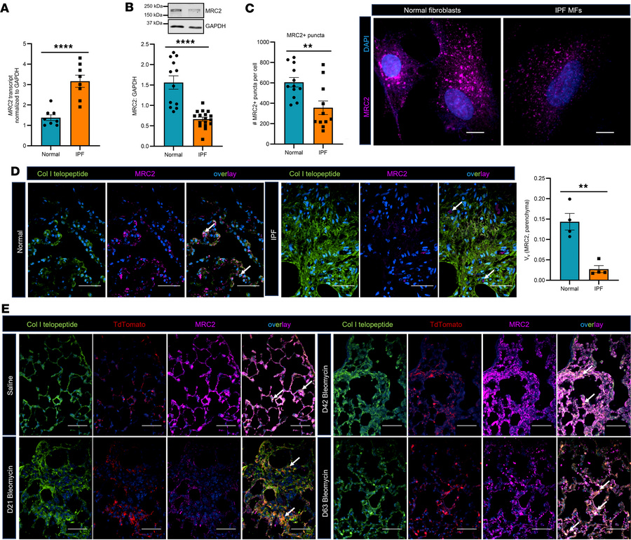 MRC2 expression is decreased in IPF MFs and in human IPF and bleomycin-i...