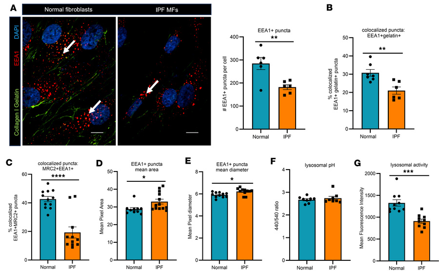 IPF MFs exhibit reduced endosomal vesicles and lysosomal activity.
(A) R...