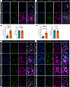 Degraded collagen is increased in IPF lung tissue and bleomycin-injured mur