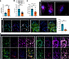 MRC2 expression is decreased in IPF MFs and in human IPF and bleomycin-inju