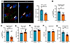 IPF MFs exhibit reduced endosomal vesicles and lysosomal activity.